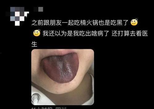 保定网红舌头被咬,网络暴力与道德反思